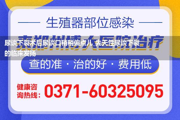 尿谈下裂术后尿谈口稍稍偏点儿_先天性尿谈下裂的临床发扬