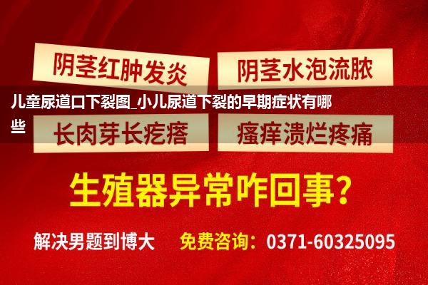 儿童尿道口下裂图_小儿尿道下裂的早期症状有哪些